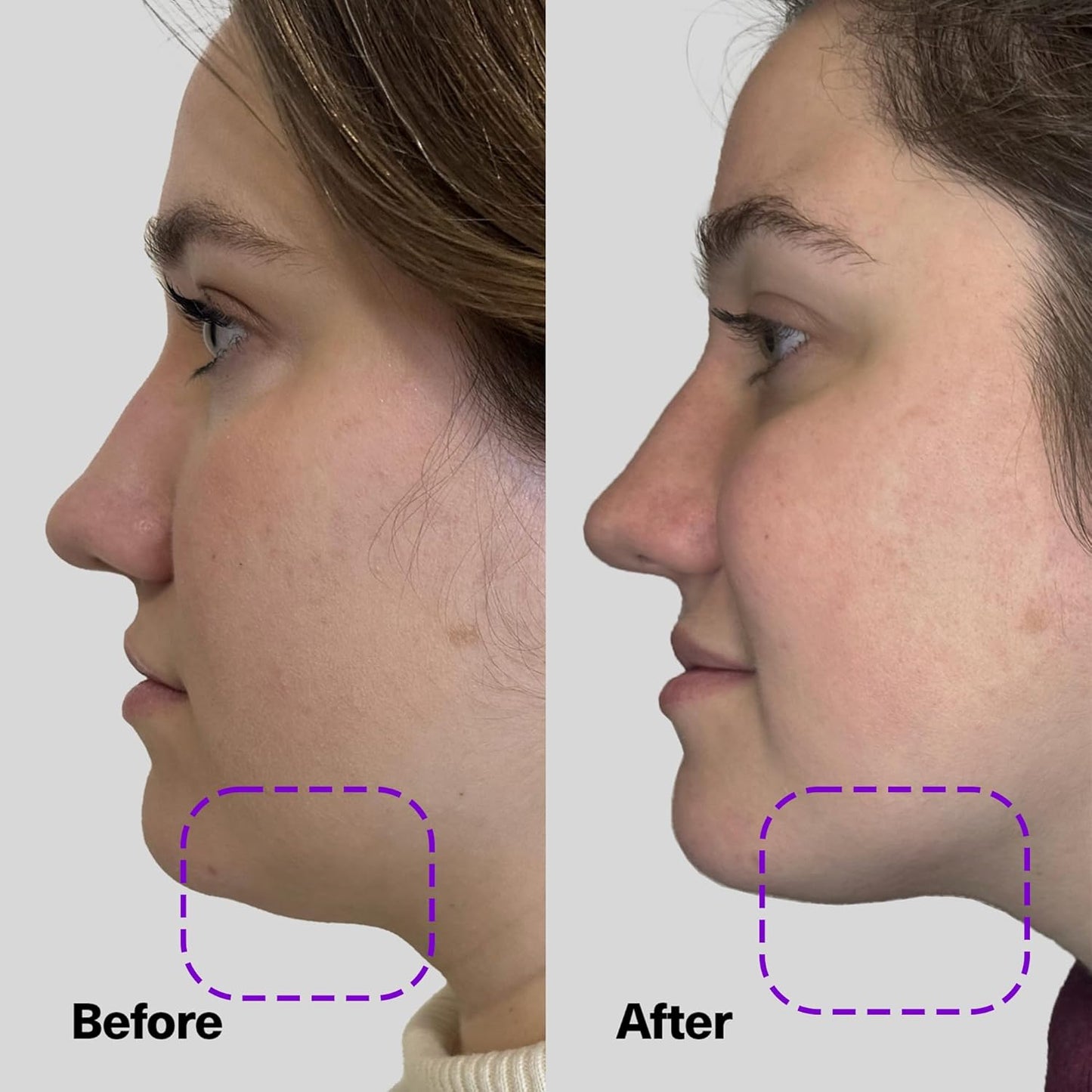 SickScience ShapeShift Advanced Jaw & Neck Firming Serum Women & Men, 1.7oz