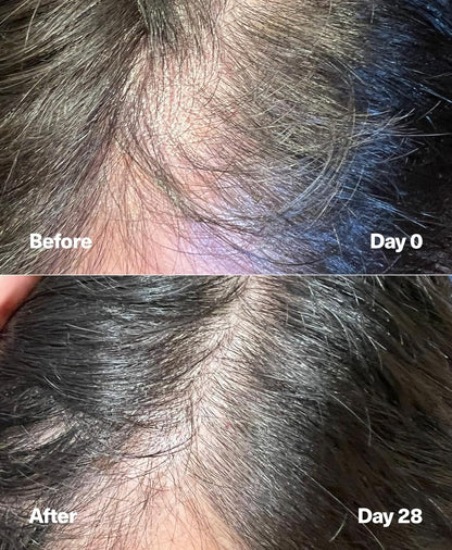 SickScience PowerCycle Exosome Hair Growth Serum - Women & Men, Without Minoxidil, 60mL