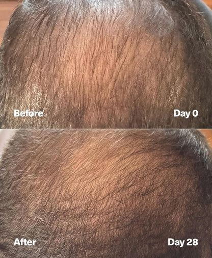 SickScience PowerCycle Exosome Hair Growth Serum - Women & Men, Without Minoxidil, 60mL